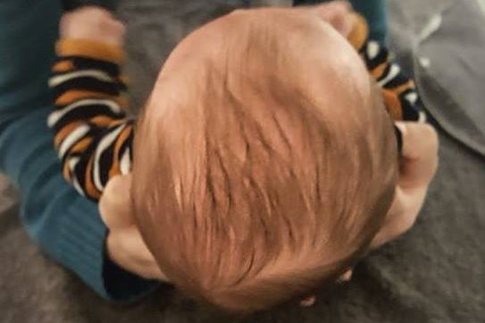 Plaglocéphalie positionnelle Haptis Ostéopathie