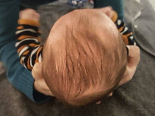 Mon Bebe A Un Cote De La Tete Qui S Aplatit Haptis Mon Bebe A Un Cote De La Tete Qui S Aplatit Haptis