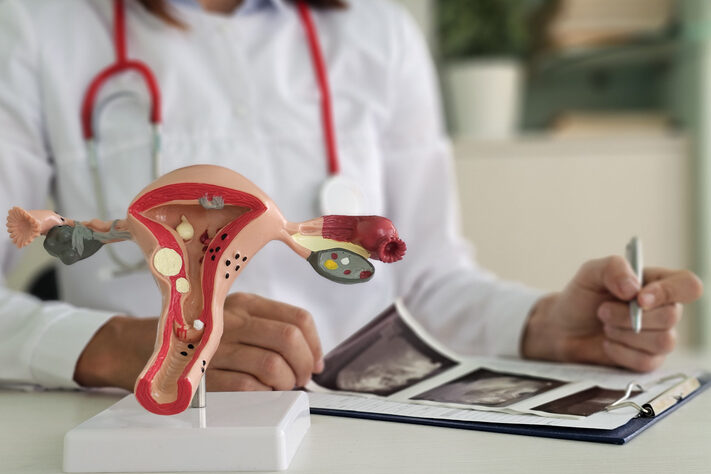 Doctor explaining changes in ovaries to patient on artificial model of uterus and showing ultrasound picture
