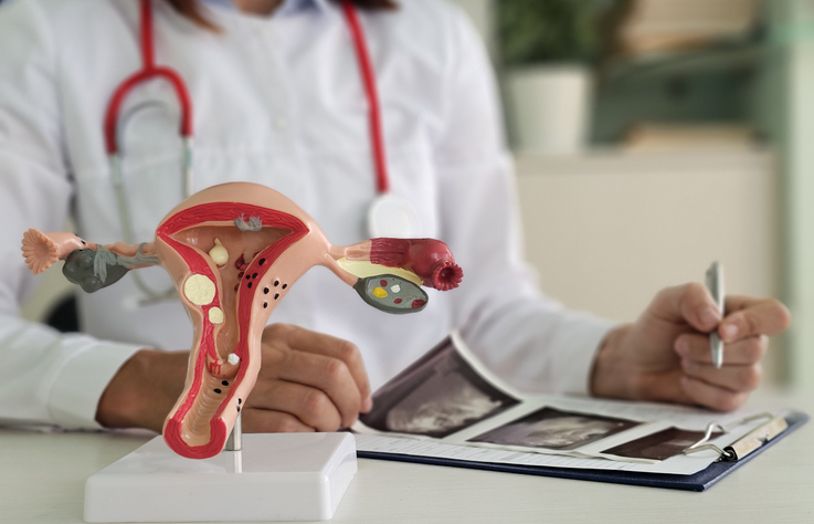 Doctor explaining changes in ovaries to patient on artificial model of uterus and showing ultrasound picture